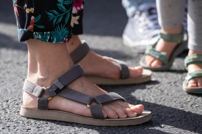 best sandals for swollen feet