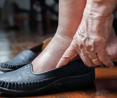 Shoes For Seniors With Swollen Feet