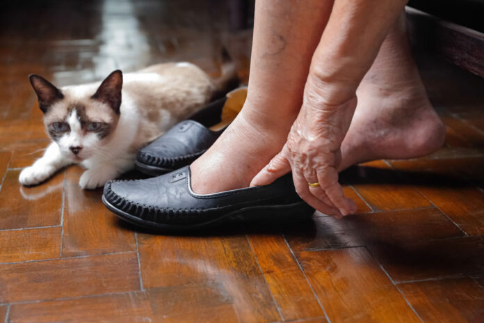 Shoes For Seniors With Swollen Feet